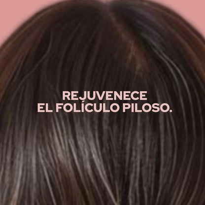 TÓNICO ANTICAIDA Y ANTICASPA ANYELUZ